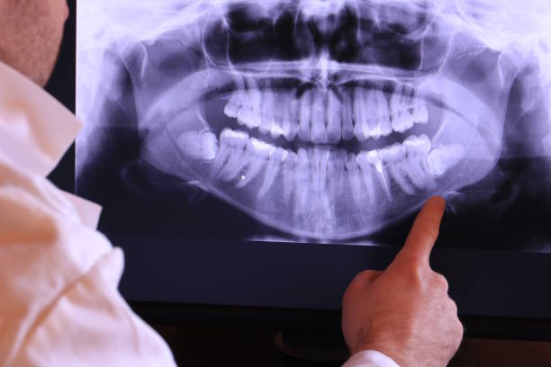 Best Emergency Wisdom Teeth Removal in Gallitzin, PA